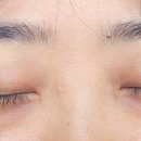 더멘토성형외과의원 이미지