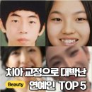 단아미소치과 | [심층분석] "성형인 줄 알았지?" 연예인 교정 전후의 진실... (feat. 저의 멘붕 상담 후기)