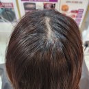 장미헤어염색방 | [잠실/송파] 머리 빠지는 이유? 90분의 기적! '큐사랑 서정화 헤어살롱' 두피클리닉 찐후기