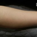 (주)와우씨앤씨 | 노원 수유 씨앤씨왁싱 / 팔왁싱 Before - After
