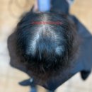 르네시떼 이미지