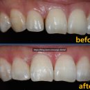 예가치과의원 이미지