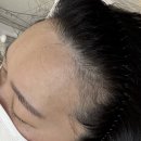 대전속눈썹수강 피부수강 대전반영구수강학원 그리다뷰티 헤어라인반영구 추천 후기 (1차시술)