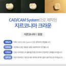중앙치과기공소 네이버블로그