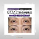 연세아이즈성형외과의원 이미지