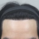 모나라피부과의원 이미지