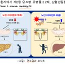 비타민 D, 노인성 지방간 예방의 새로운 희망 이미지