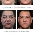 엑시온(Exion) 이미지