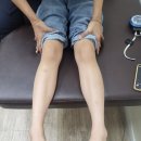 동탄에이치드림과 아이레그플러스 안짱다리 엑스자다리 진료후기