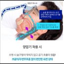 지앤지메디 | 코골이치료 위해 양압기 결정! 2년 사용 후기와 장단점 총정리