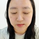 청량회전교차로(북서) | 세종피부관리 핸즈온유 세종본점 | 모공스케일링 후기
