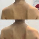 미인나라 | 청주 후광미인 굽은 몸 펴주고 얼굴 탄력까지 얻은 등관리 후기