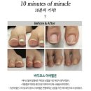 네일아띠 이미지