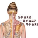 골드체형관리 이미지