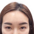 예뻐진의원 이미지