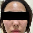 뷰티온의원평택고덕점 이미지