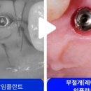 에이플란트치과의원 이미지