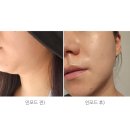 삼성밴스의원 이미지