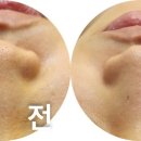 피오레에스테틱