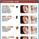 바로보청기