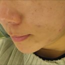 라클스토어 | 여드름피부 오일클렌저 추천 :: 예민한 피부도 순하게 지우는 에스테틱 리라클 워시겔 사용후기