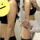 남일약국 | 강남 다이어트약 처방 후기 메이드유의원 일주일 변화 솔직 후기 (일주일만에 3kg!!)