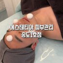 송도 피부관리 받고 피부결 달라진 후기｜에스테티아 송도1호점 스페셜 모공앰플관리