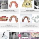 의료계에서의 3D 프린터 활용 이미지