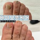 장안27 | 장안동 문제성발톱 관리 바이오풋케어 장안점 방문 솔직후기 (무좀발톱·내성발톱)