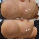 도봉-쌍문-도봉-1154 | 도봉구에스테틱 늘품에스테틱 색소와 토닝관리는?