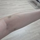 [임당기록] 시지 파티마여성병원 임당 재검 및 채혈측정 준비물 등 과정 후기