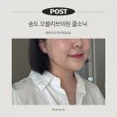 송도 오블리브의원 쿨소닉 3000샷 후기, 이중턱·심부볼·볼처짐 고민 솔직 후기