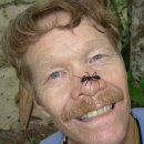 [가만한 당신] 곤충 독침에 '몸' 바친 과학자 이미지