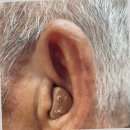 난청엔보청기부천센터 이미지