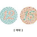 색약[color amblyopia] 눈질환 이미지