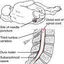 lumbar 이미지