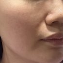 아름다운코스메틱 | 아름다운코스메틱 플란트 엑소좀 시카 마스크팩 후기 (쿨링감, 밀착력, 수분감)