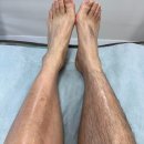 수원-0884 | 수원 호매실 왁싱 남자 다리 제모 덜 아프고 덜 민망하게 잘해주세요