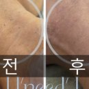 유니드케어 이미지