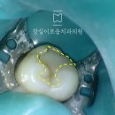 잠실이로움치과 이미지