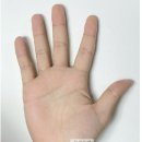 서금요법(수지침)중급 이미지