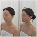 에이원 | 구미웨딩관리 산동 에이원뷰티 솔직후기