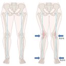 비스타짐 이미지