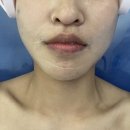 예담궁테라피 | 창원웨딩케어: 창원 피부관리, 창원에스테틱 예담에스테틱 추천 / 수분 촉촉 물광 케어 / 관리 전후사진...