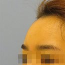 이마 이미지