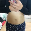 라율한의원 | 대구 라율한의원 쿨쎄라 후기 가져왔어여!!!