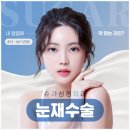 슈가성형외과의원 | 쌍꺼풀수술, 눈 재수술은 슈가성형외과에서~