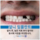 열린치과기공소 이미지
