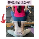 snpe체형교정 이미지