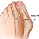 누리보조기 이미지